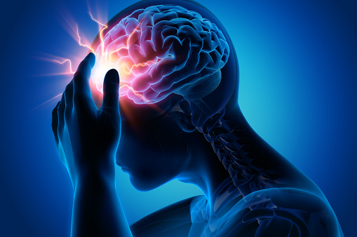 EYE eN ocular migraine 1156927795