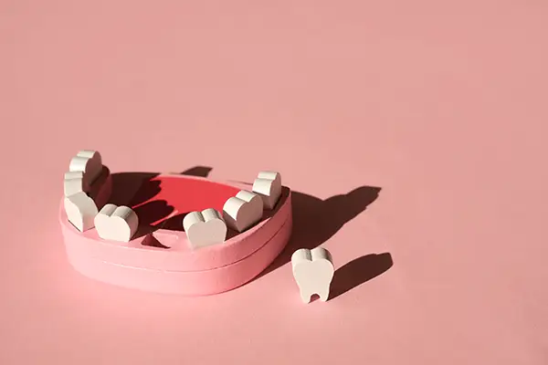 A dental model with one tooth removed, placed separately to illustration tooth loss.